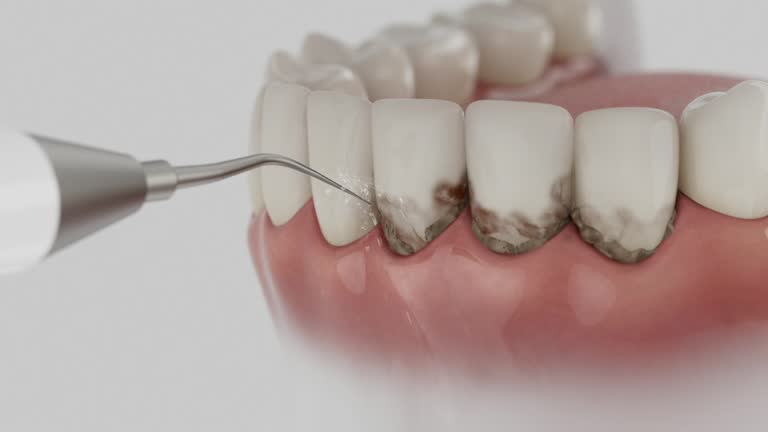 Reliable Tooth Extraction contractor in Upson County County, GA by Dentist Open Now